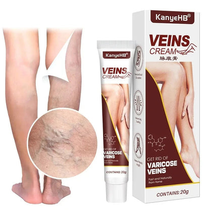 Crème Anti Varice Kanye™ : Restaure les veines endommagé✨